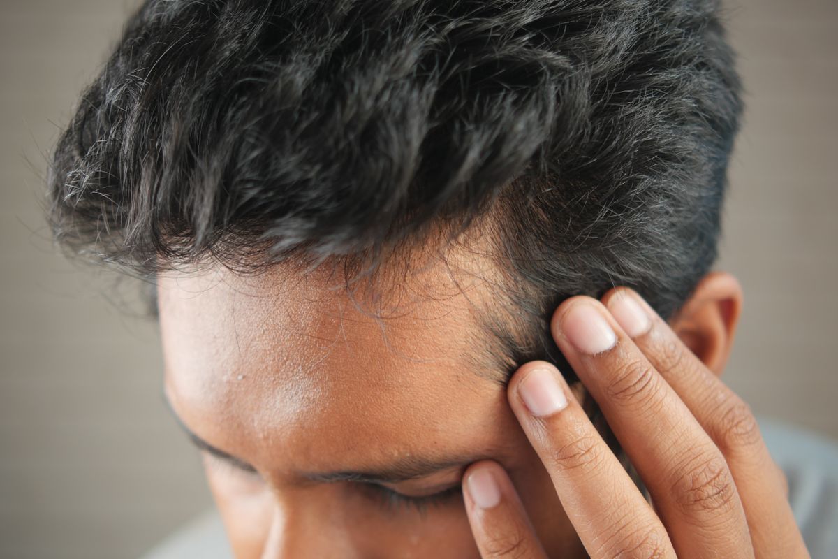 A man checking his thinning hairline in concern, the moment before he starts researching hair restoration clinics