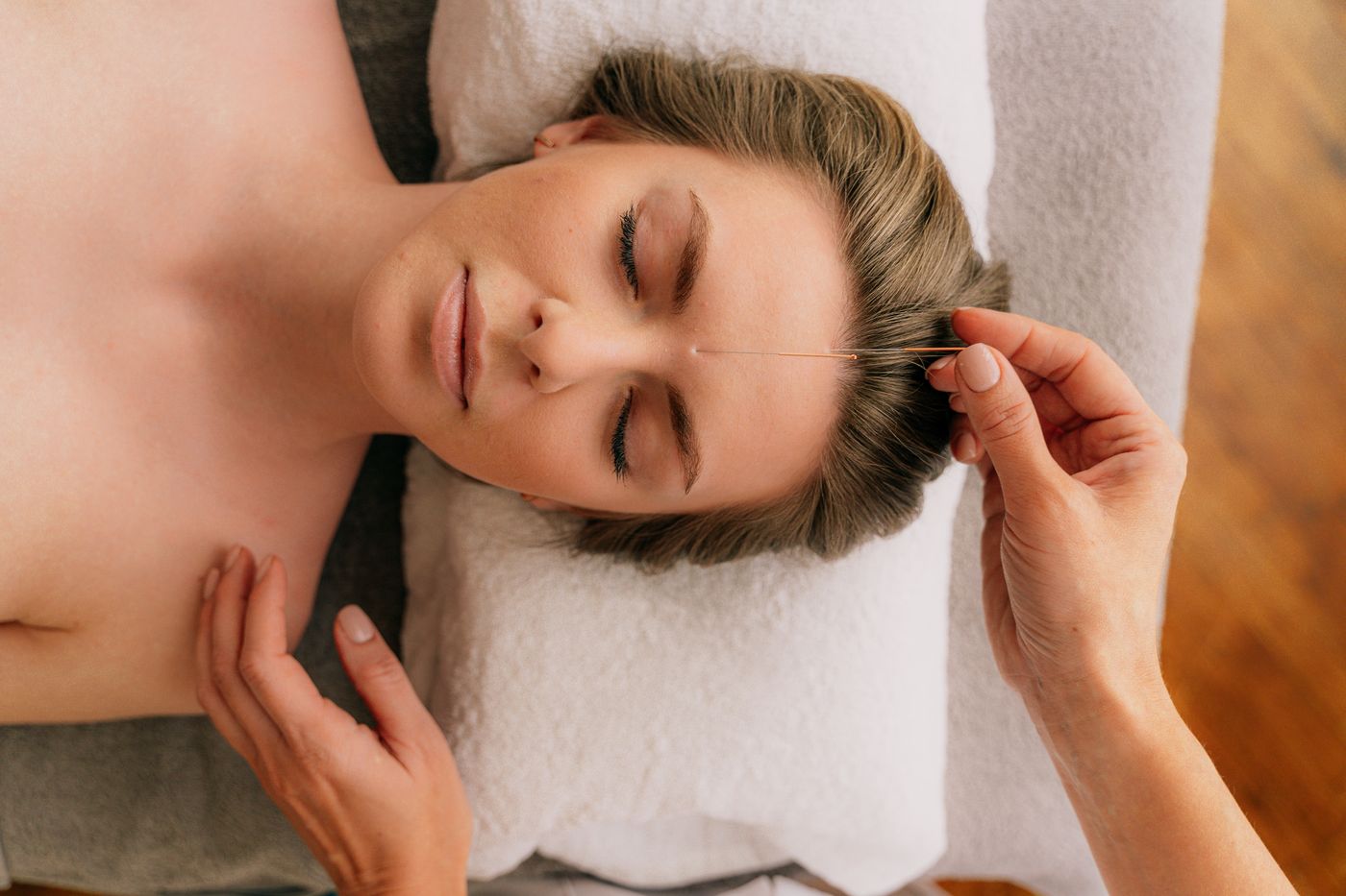 An acupuncturist placing a fine needle near the head of a relaxed patient lying on a treatment table, representing acupuncture care and patient trust