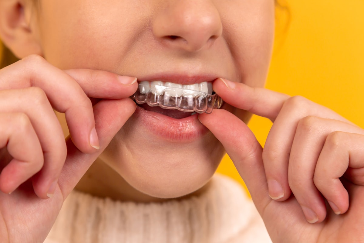 A person placing a clear aligner tray, illustrating how patients research and choose an Invisalign practice